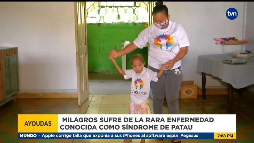 Milagros Peña sufre del raro síndrome de Patau, ella necesita tu ayuda
