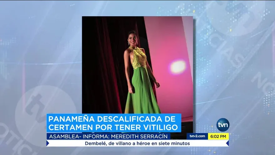 Excluyen a Miss Turismo Panamá de concurso internacional por padecer vitíligo