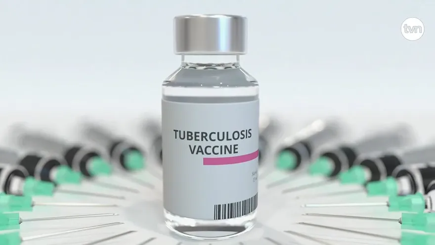 Advierten sobre tuberculosis congénita y muerte materna