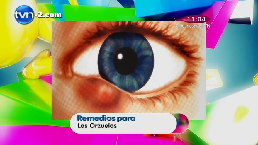 El Yerbatero -  Remedios para el Orzuelo