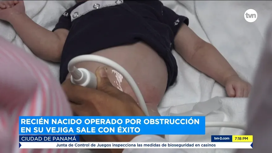Recién nacido intervenido por obstrucción en su vejiga sale con éxito.