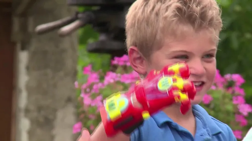 Niño francés recibe prótesis impresa en 3D