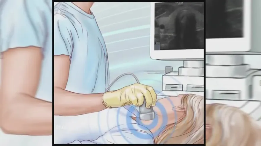 ¿Cuáles son las causas del bocio?