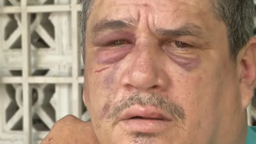 Taxistas chorreranos son víctimas de los delincuentes