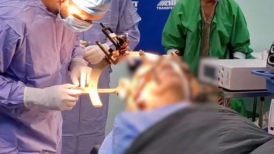 Cirugía para pacientes con Parkinson puede mejorar hasta 80% los síntomas motores