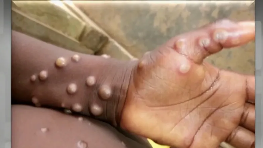 Recuerdan mantener la seguridad ante los virus que circulan