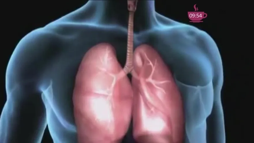 El cáncer de pulmón: uno de los más letales en Panamá