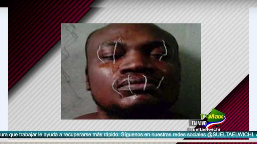 Tonelada habla de Mr. Fox y su cocida de boca y ojos