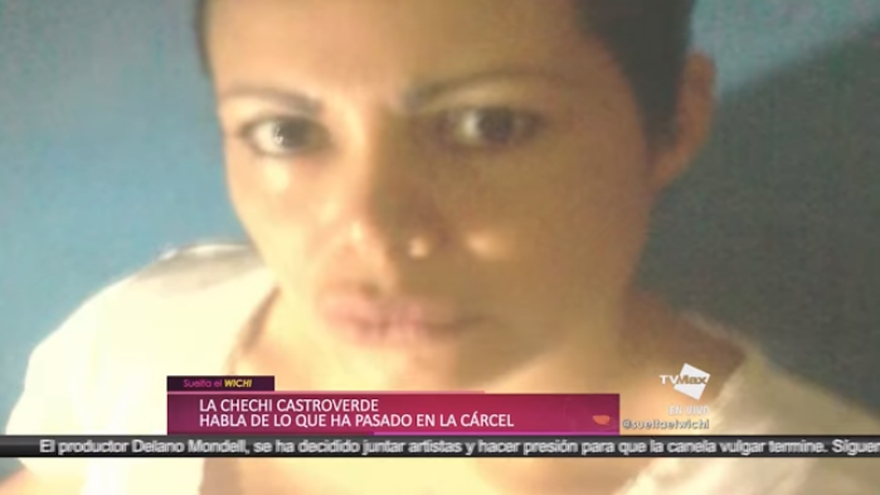 La Chechi padece de angiodema