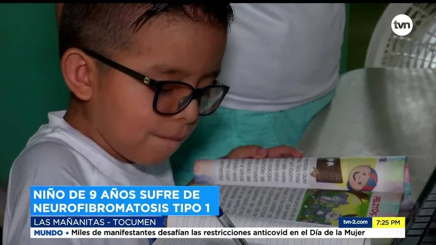 Eliud Selva, un niño con una rara enfermedad necesita tu ayuda