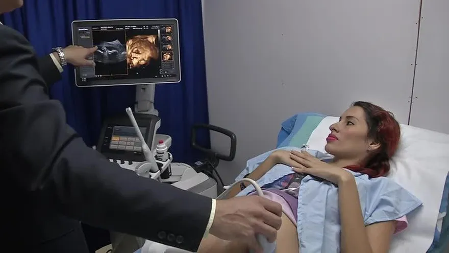 Nuevo sistema de ultrasonidos en 3D y 4D