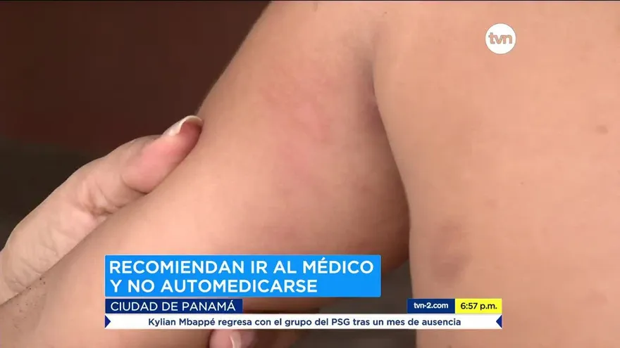 Ministerio de Educación confirma brotes de alergias en varios centros educativos