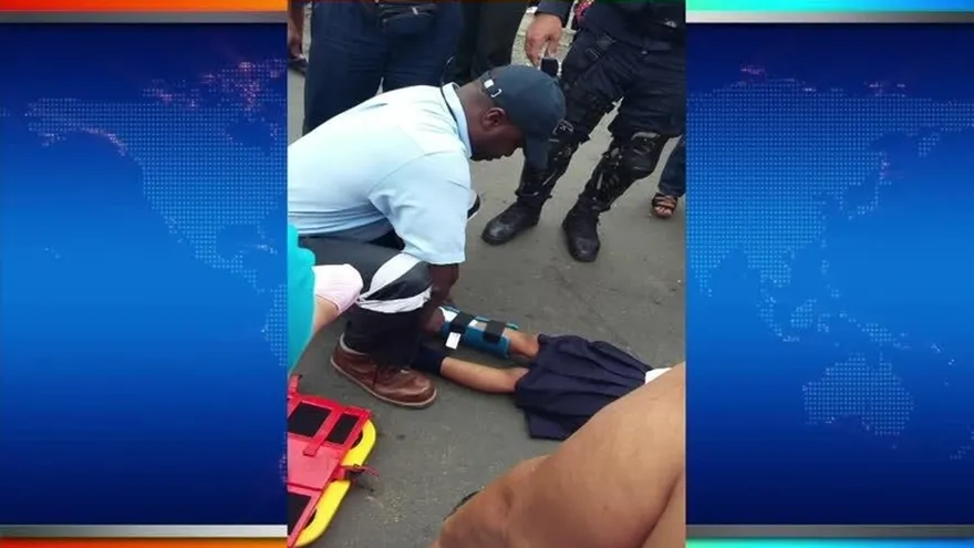 Menor en Tocumen sufre herida a causa de conductor