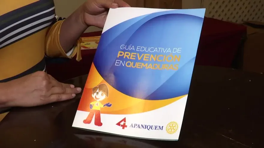 APANIQUEM realiza actividad sobre la prevención de quemaduras