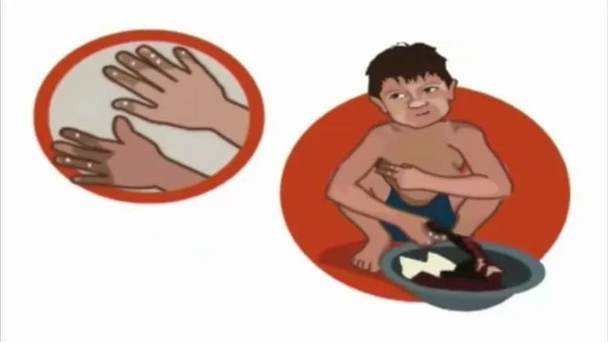 Alerta por casos de parásitos en los niños