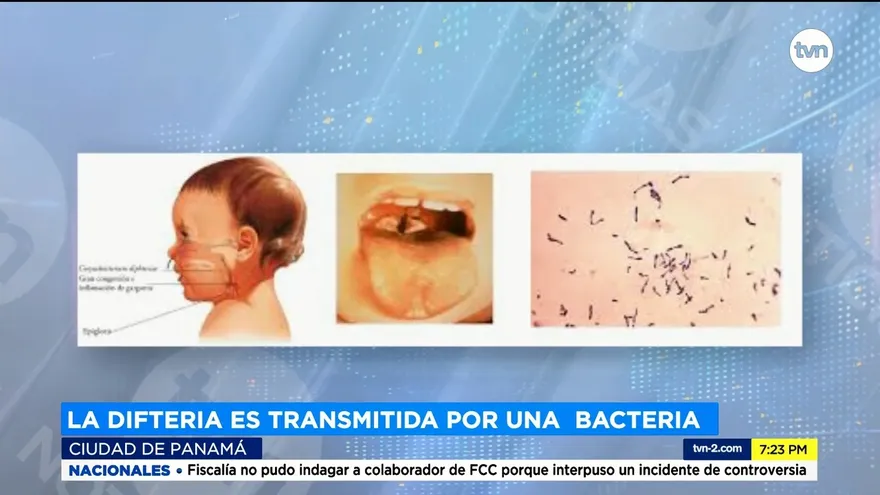 Perú declara alerta epidemiológica por difteria