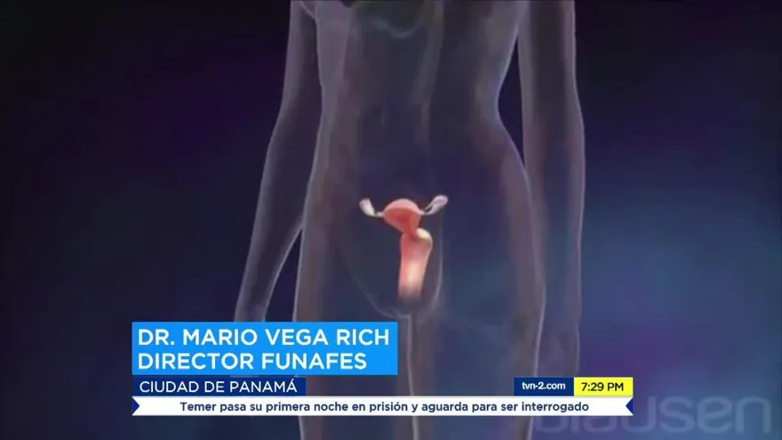 Mujeres en Panamá puede padecer endometriosis sin saberlo