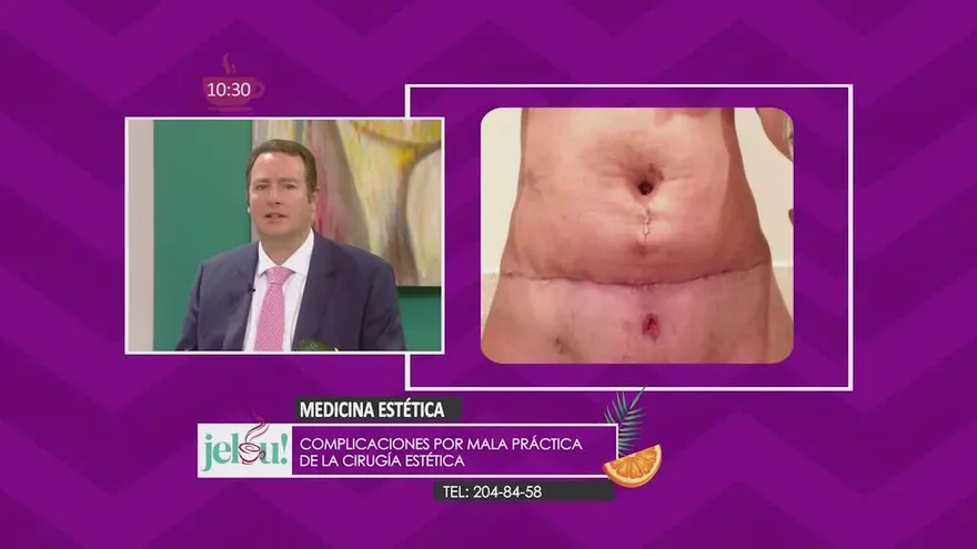 ¡Ojo! Mira cómo pueden complicarse algunas cirugías estéticas