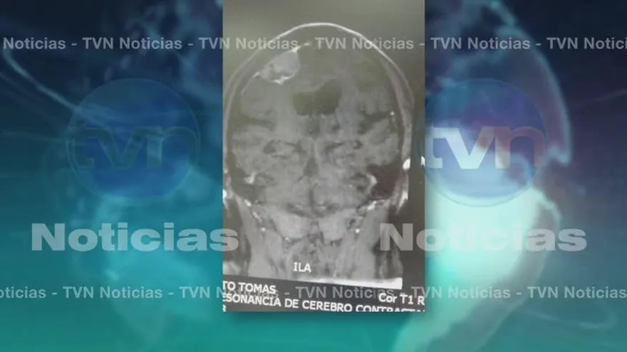 Panameños opinan sobre estado de Salud de Noriega