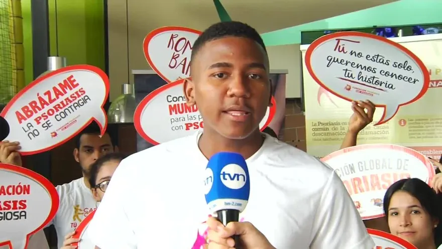 Más de 60 mil personas padecen de psoriasis en Panamá