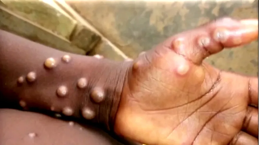 Lo que hizo noticias en el 2022: Salud