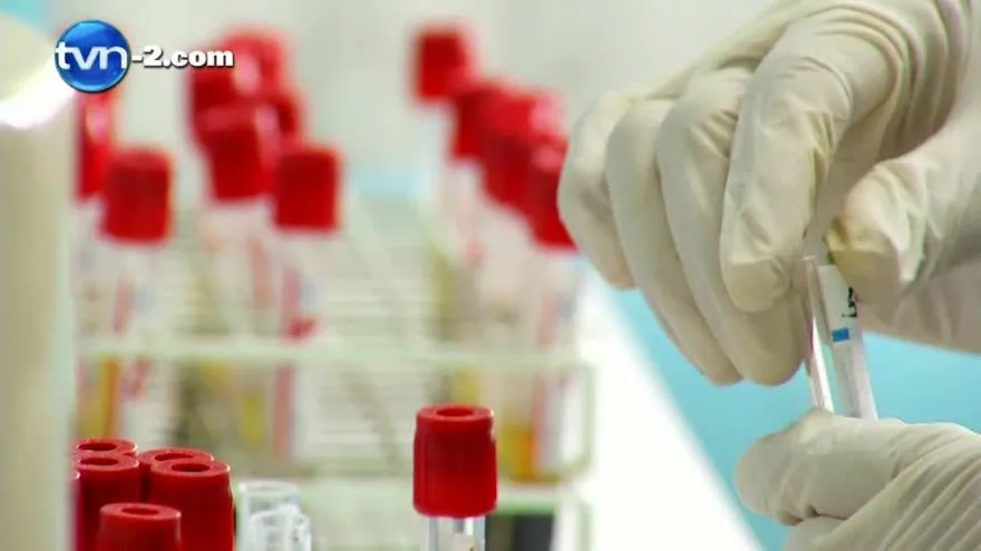 Entidades de salud registran 100 casos de VIH por mes