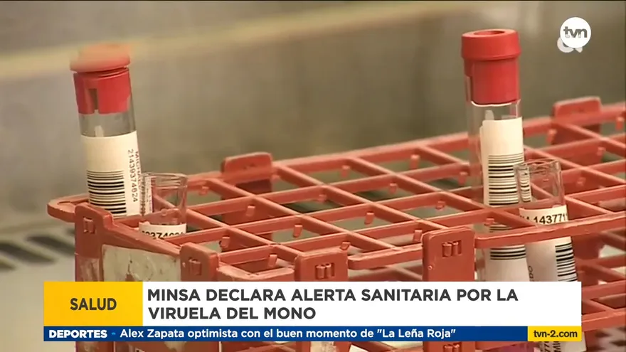 Habilitan sala parar tratar posibles casos de viruela de mono en el San Miguel Arcángel