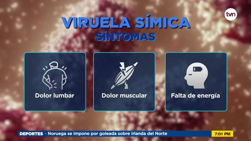 Recomiendan aislamiento en casos de viruela del mono