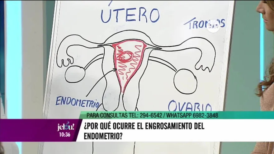 Conoce qué es realmente el endometrio engrosado y los problemas que puede causar en una mujer