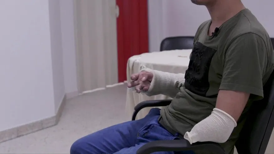 Prótesis en 3D devuelven la esperanza a mutilados de guerra