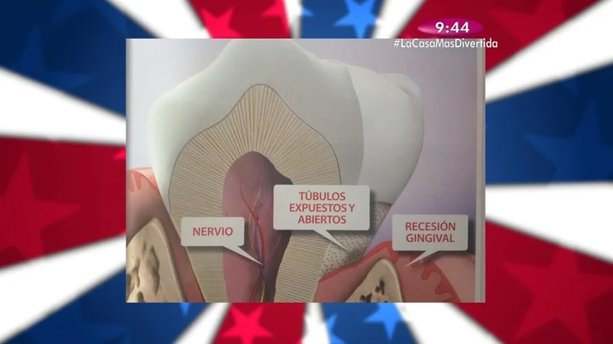 Salud Dental - Dientes Sensibles, Qué lo Causa