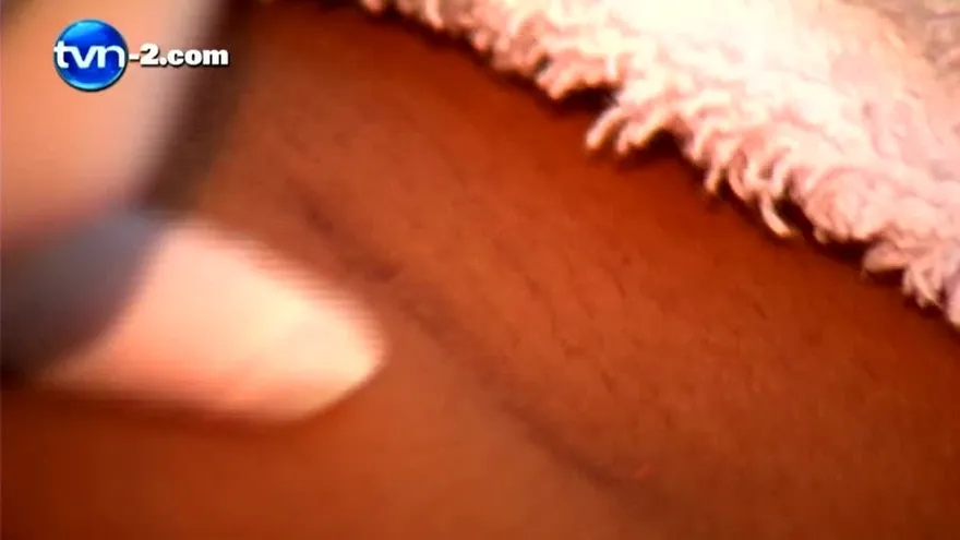 PEELING PARA  MANCHAS