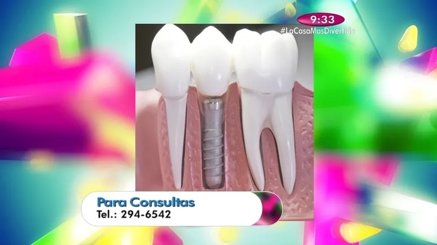 Salud Dental - Implantes  Dentales