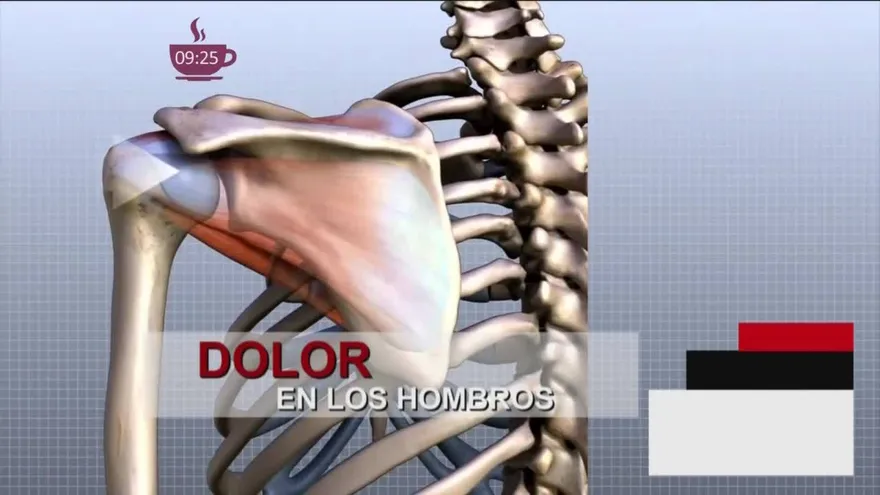 ¿Tienes dolor en el hombro? Averigua por qué