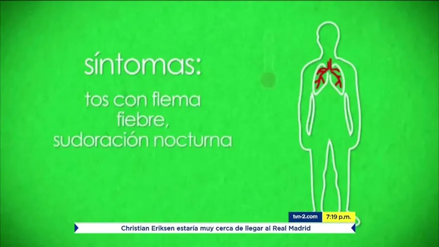 Preocupación por aumento de casos de tuberculosis en Panamá