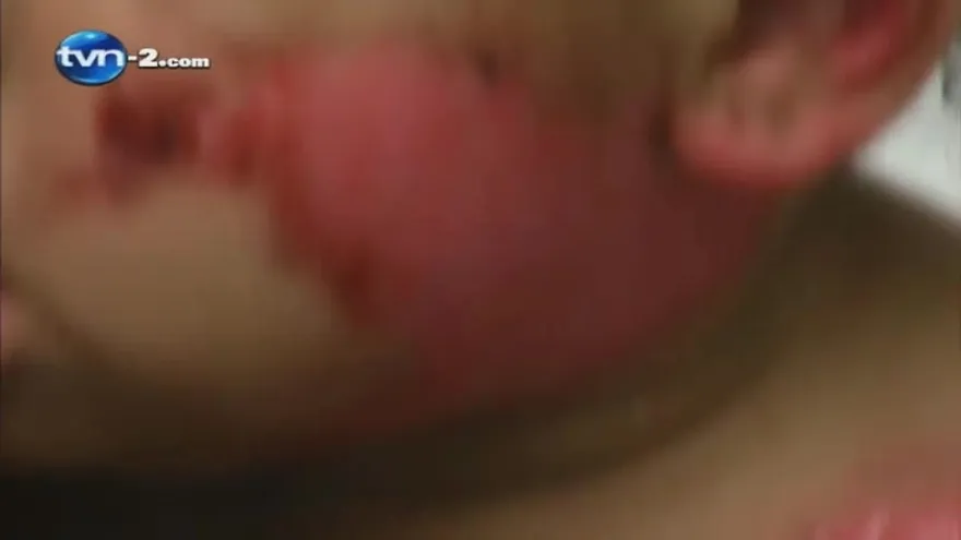 Consejos para Evitar accidentes con Fuegos Artificiales