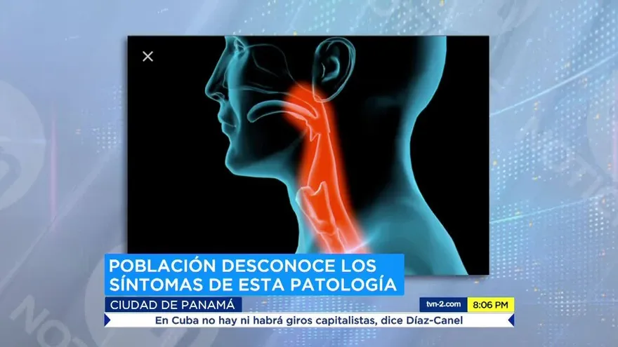 Aumentan casos de cáncer de cabeza y cuello