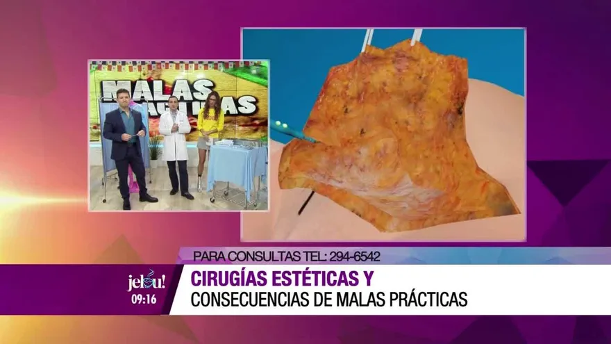 Cirugías estéticas ¿Cuáles son las consecuencias de la mala práctica?