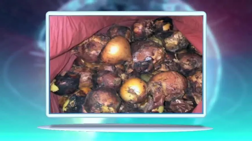 Cebollas holandesas contaminadas