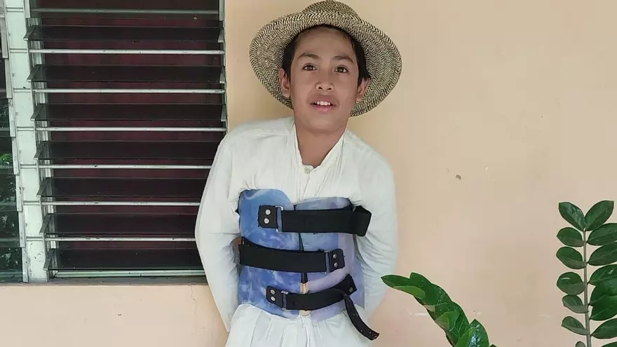 Giovanni González de 11 años de edad, presenta escoliosis severa.