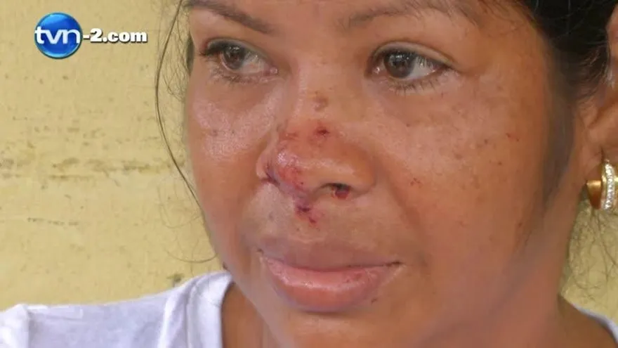 Mujer herida en corredor