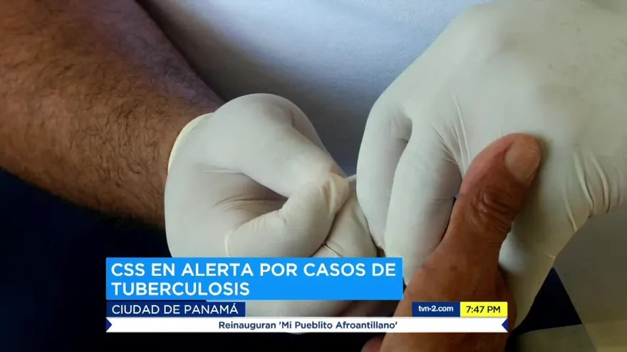 Autoridades en alerta ante casos de tuberculosis