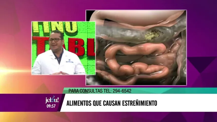 Conoce cuáles son los alimentos que causan estreñimiento