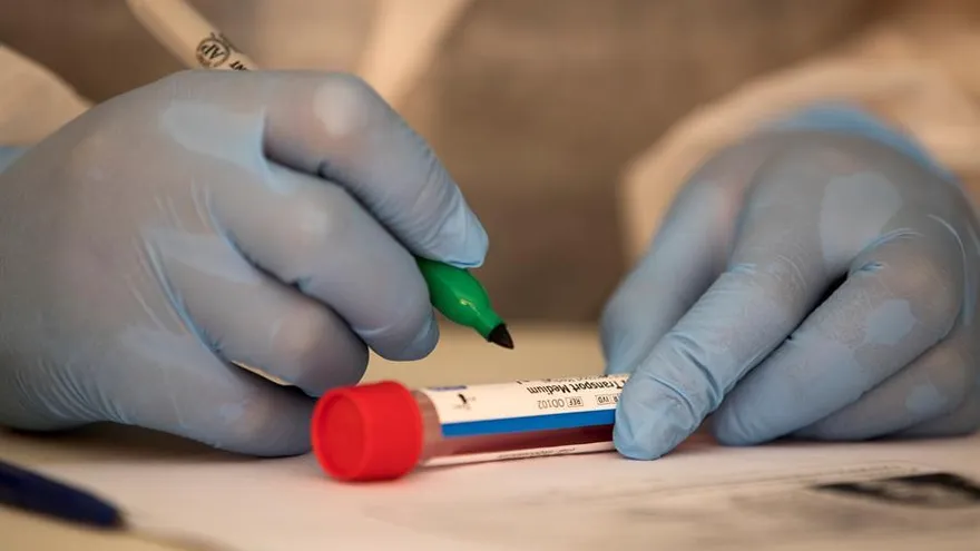 Los casos de coronavirus a nivel mundial alcanzan los 29,1 millones