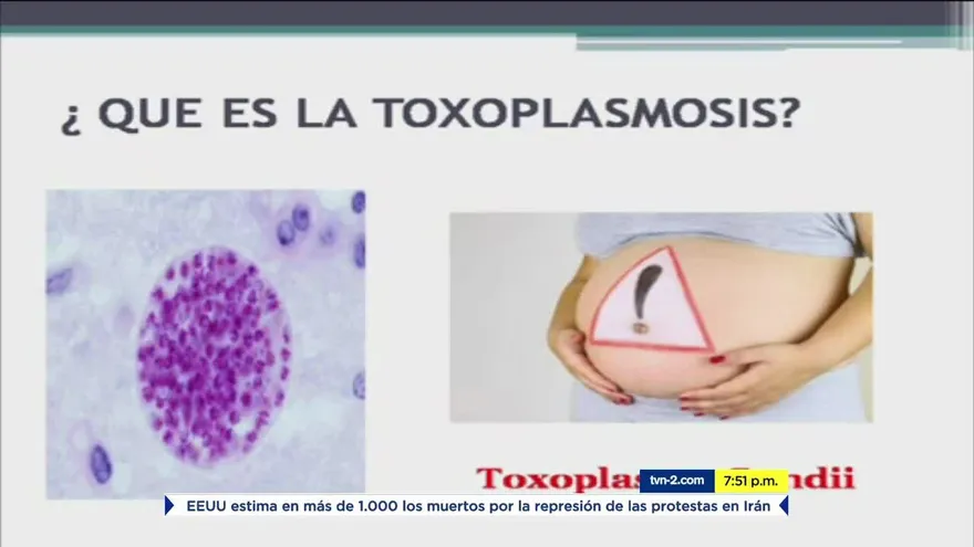 ¿Qué puede provocar el toxoplasmosis?