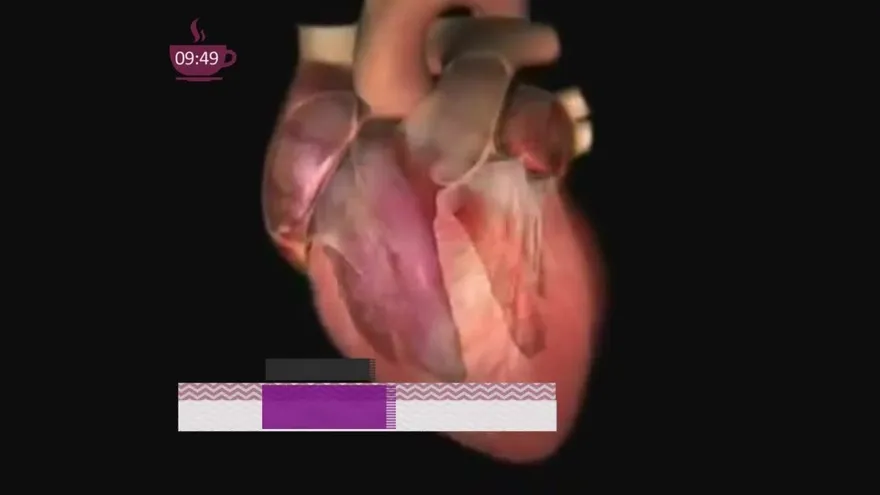 ¿Cómo mantener sano el corazón?