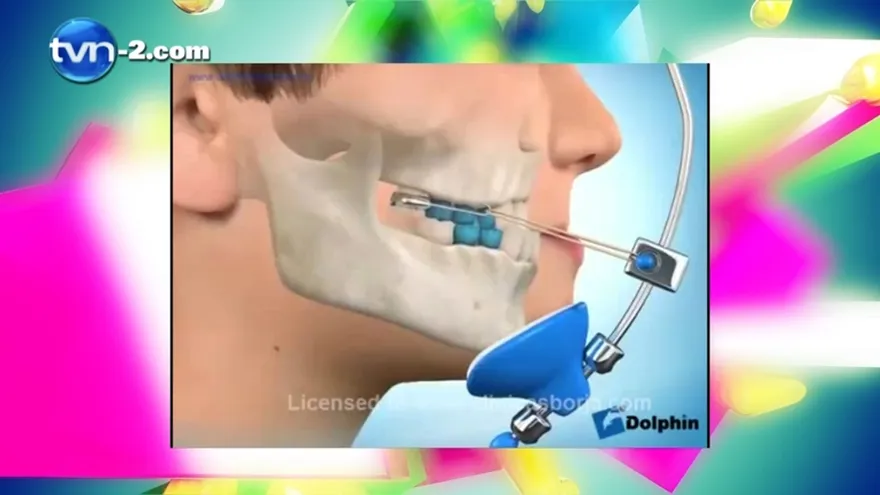 Salud Dental - Importancia de la ortopedia odontofacial
