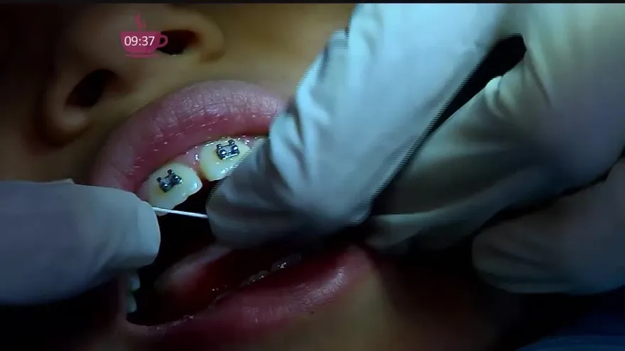 Cómo cuidar la salud dental en nuestros hijos