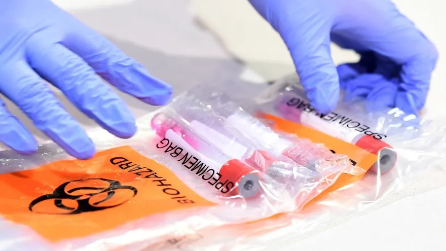 EEUU lanza ensayo clínico de anticuerpos sintéticos contra la COVID-19