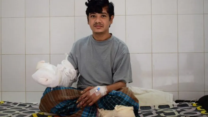 Abul Bajandar, ampliamente conocido como 'El Hombre Árbol' por su enfermedad de verrugas, se relaja en un pabellón del Dhaka Medical College Hospital, en Dhaka.